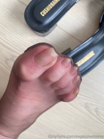 explosivetoess Photo Fuites Nudes OnlyFans 33