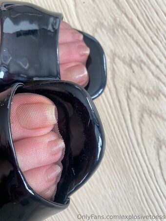 explosivetoess Photo Fuites Nudes OnlyFans 34