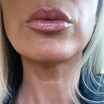 Nipsstrips Photo Fuites Nudes OnlyFans 4